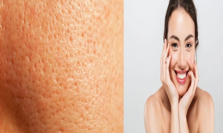Minimize Facial Pores: 5 Tips to Hide Open Pores with Makeup