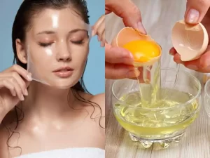 Home remedies for blackheads 