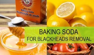 Home remedies for blackheads